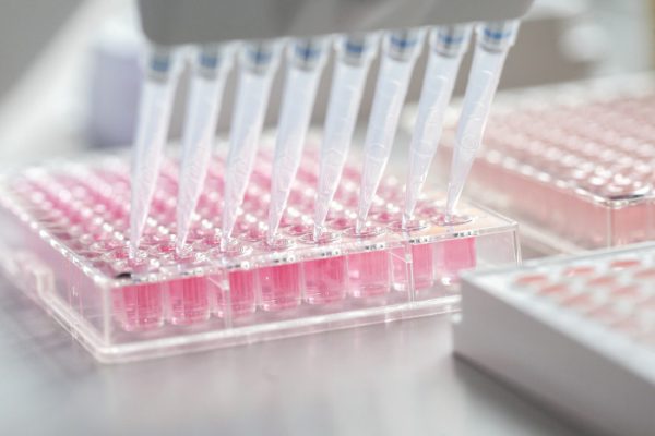 Rack of test tubes